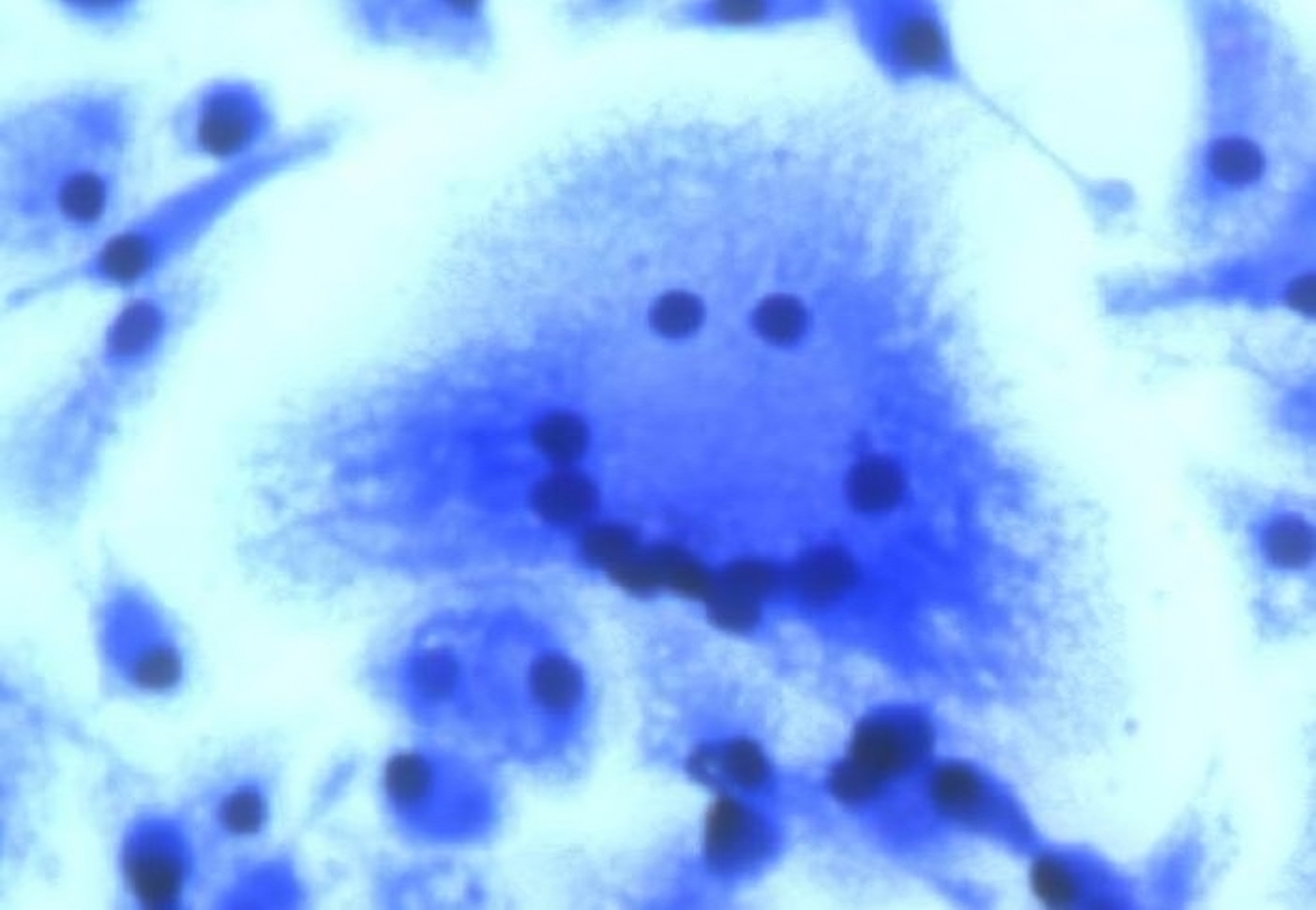 A smiling, multinucleated macrophage