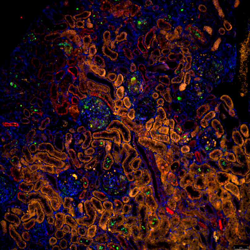 Macrophages in the rat kidney